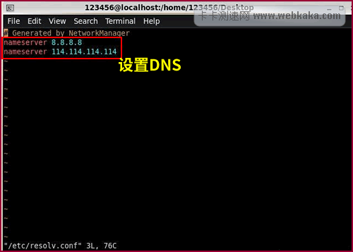 Linux設(shè)置DNS